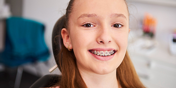 Aparatul dentar – calea spre un zâmbet strălucitor