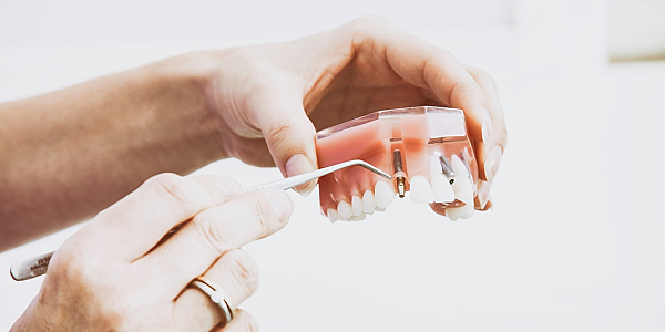 Dinți lezați sau traumați? Tratamentul stomatologic cu ajutorul pivotului dentar îți va salva dantura