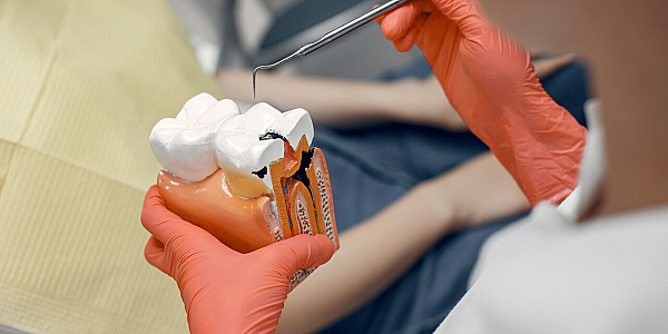 Sistemul all-on-four și all-on-six cu încărcare imediată: Ce trebuie să știți despre aceste tehnologii inovatoare pentru implanturi dentare
