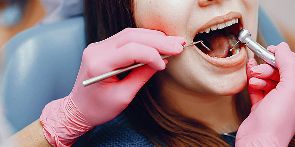 Dental Filling: When Is It Necessary?