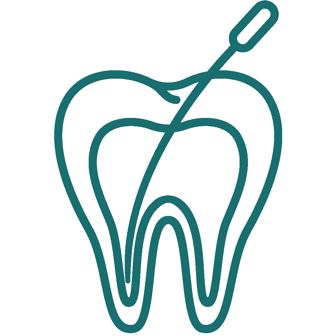 Endodonție (Tratament de canal)