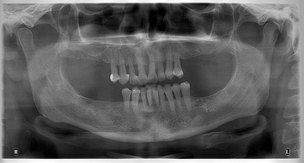 Alege serviciile stomatologice oferite de DentArbre. Vei cunoaște toate etapele tratamentului de la bun început, durata, costul total. În plus, îți oferim instrumente de plată precum plata în rate și costuri corecte pentru toate tratamentele stomatologice. De asemenea, poți consulta costurile online, pe pagina Prețuri.