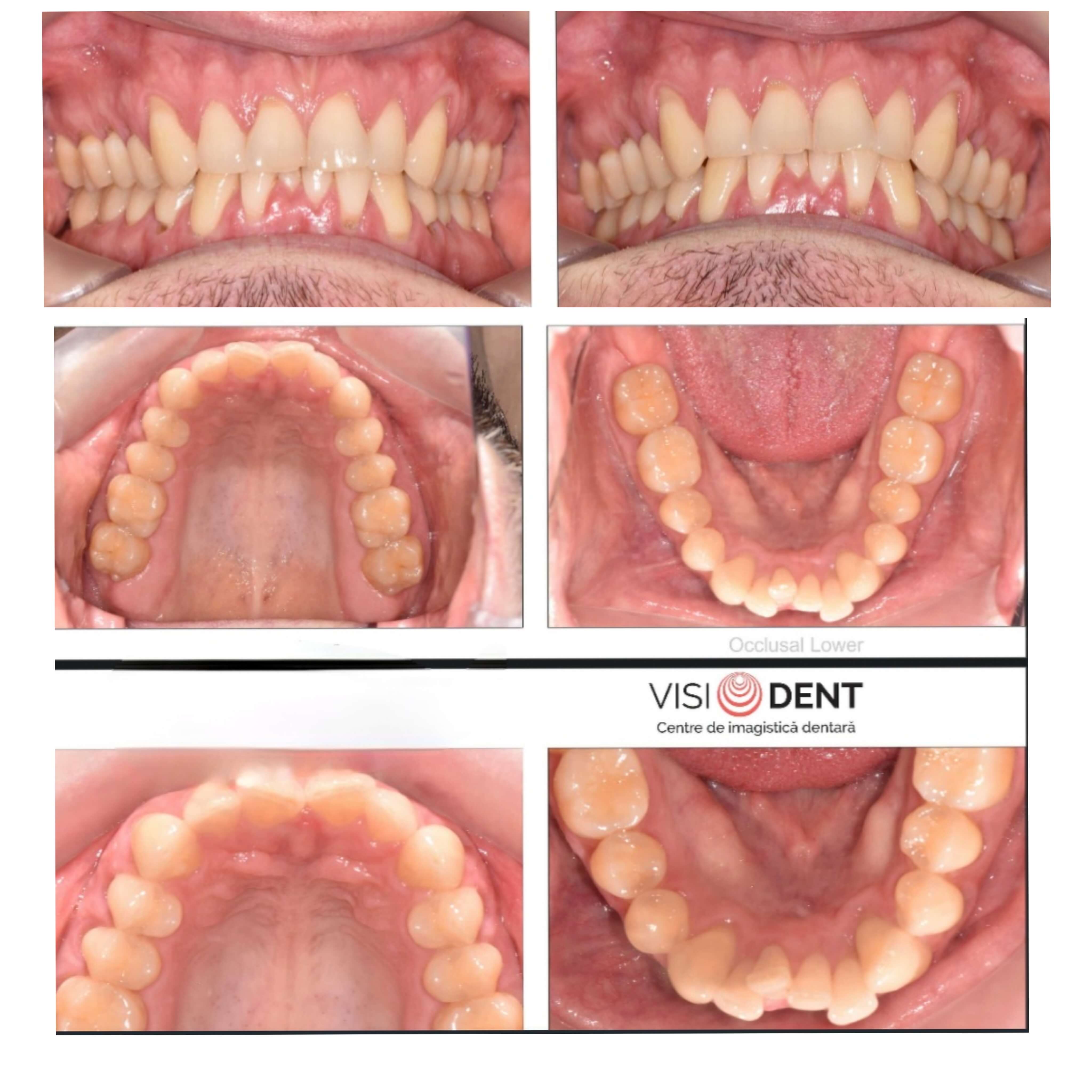 Alege serviciile stomatologice oferite de DentArbre. Vei cunoaște toate etapele tratamentului de la bun început, durata, costul total. În plus, îți oferim instrumente de plată precum plata în rate și costuri corecte pentru toate tratamentele stomatologice. De asemenea, poți consulta costurile online, pe pagina Prețuri.