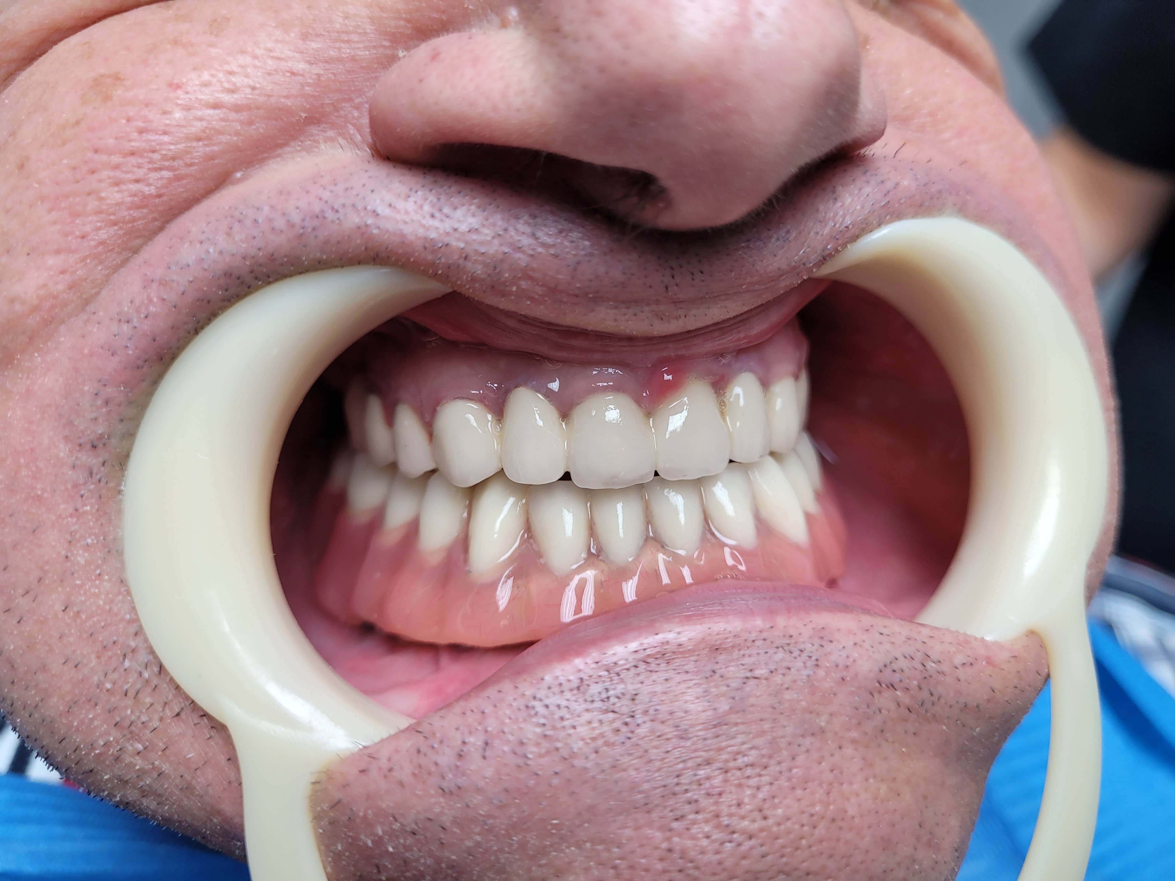 Choose the dental services offered by DentArbre. You will know all the stages of the treatment from the very beginning, the duration, the total cost. In addition, we offer you payment tools such as installment payments and fair costs for all dental treatments. You can also consult the costs online, on the Prices page.